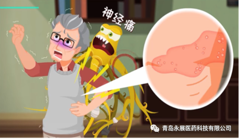 带状疱疹后遗神经痛——多么痛的领悟！
